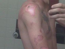 left shoulder