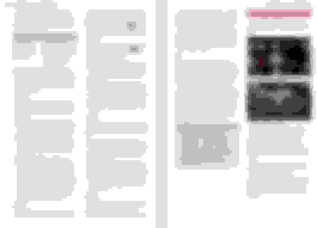 UK Air suspension VCDS lowering Question before committing