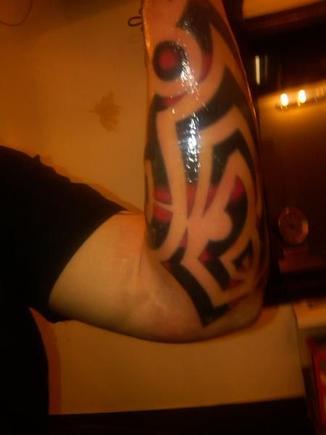 got it finally done.  been healed up and about a month since it was completed.