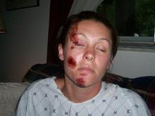 Good thing I had on a skull cap or I would be dead.