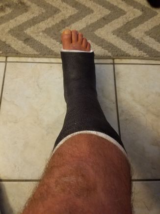 Plate,pins,screws,tendon and ligament reattachment. SUCKS! Biketoberfest...and grounded.   😯