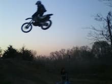 boyfriend jumped over me on dirtbike... he didnt no i was there. i look like i have a mustache