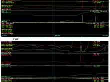 See EGTs under cruise, top is with the EWP setup, bottom is a typical log with the mechanical pump and reroute