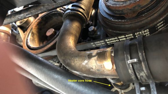 Straight on view of the lower radiator hose