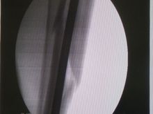 Leg2.jpg