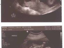20 weeks ultrasound.JPG