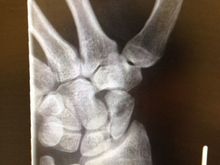 xray2
