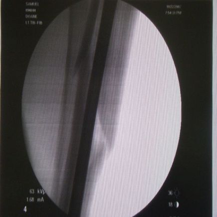 Leg2.jpg