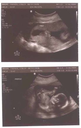 20 weeks ultrasound.JPG