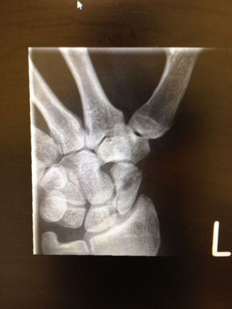 xray2